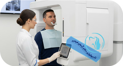 CBCT دندان