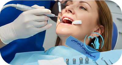 تحلیل سه‌بعدی استخوان فک برای ایمپلنت | رادیولوژی دکتر آرمان فیض